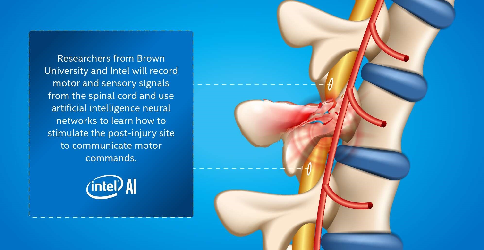 英特尔AI团队研发智能脊柱接口，帮助瘫痪者站起来！